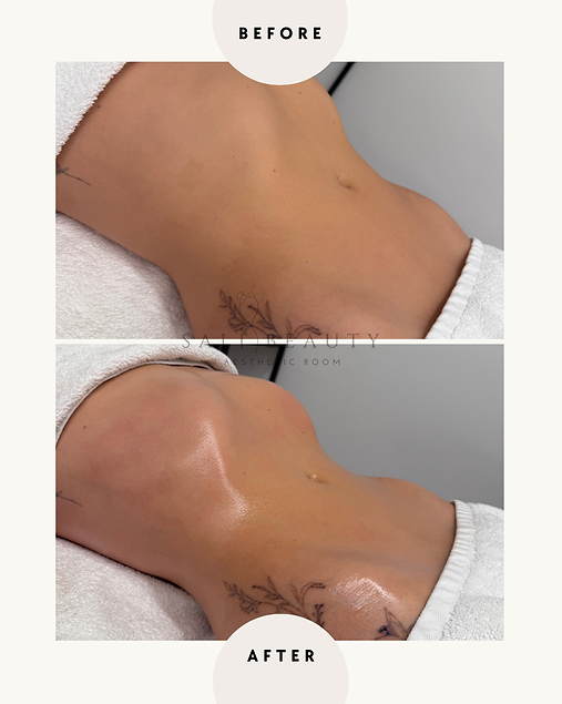 Jeder Körper ist ein Traumbody.