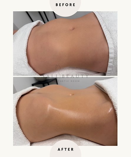 eine Lymphdrainage, wie sie im Buche steht - mit dieser Methode werden WOW-Momente geschaffen.