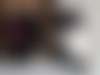 Sufre caída el papa Francisco: le inmovilizan el brazo pero no hay fractura