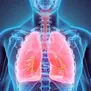 Uno de cada 3 pacientes con cáncer morirá sin diagnóstico hacia el 2050, según estudio