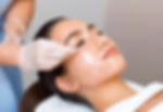 chemical peel