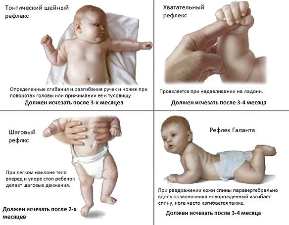 ДЦП2.jpg