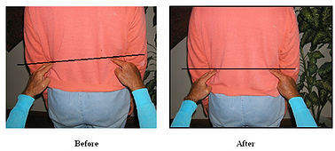 BoneAdjustment.jpg