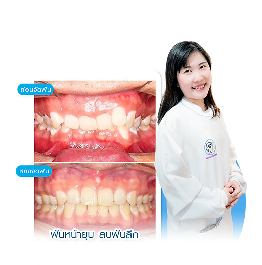 หมอใหม่ คลินิกรวมทันตแพทย์ จัดฟัน คลินิกทำฟันมหาชัย "ทำฟันปลอมมหาชัย"