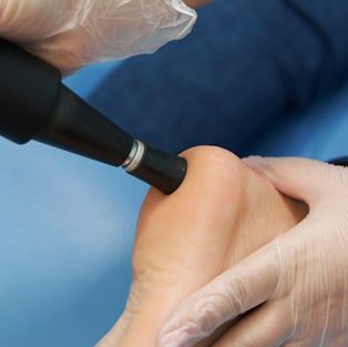 How Does Shockwave Therapy for Achilles Tendonitis Actually Work?