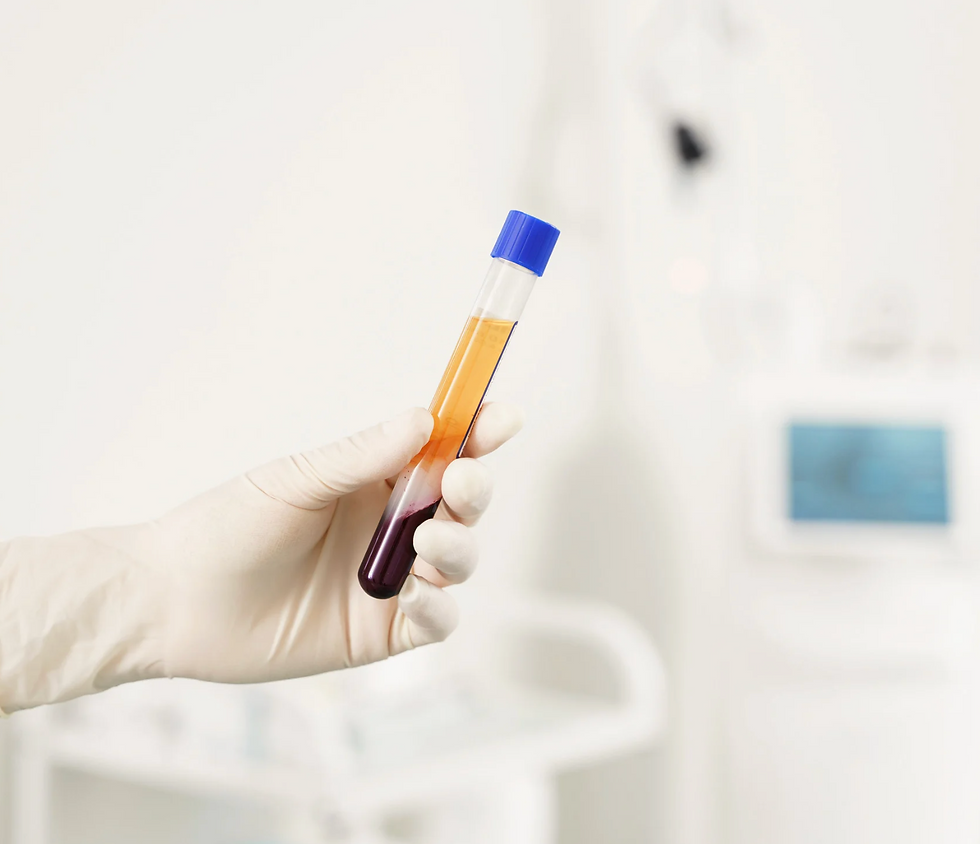 PRP therapy blood sample tube being held for platelet-rich plasma treatment.