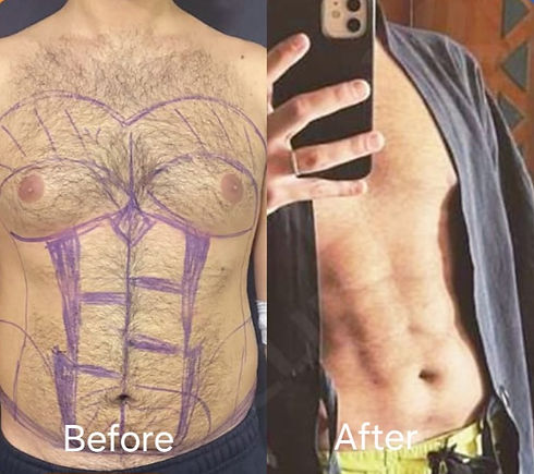 Plastic-Surgery-8.jpg