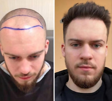 hairit2_edited.jpg