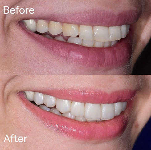 Dental-Health-7.jpg