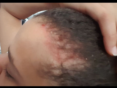 HAIR PH BALANCE, SCALP HEALTH.