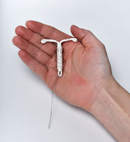 iud.jpg
