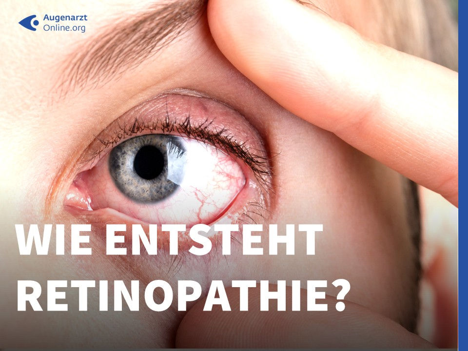 Wie entsteht Retinopathie?