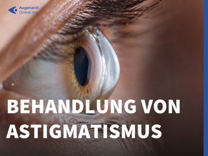 Hornhautverkrümmung (Astigmatismus) – Ursachen, Behandlung und Risiken im Überblick