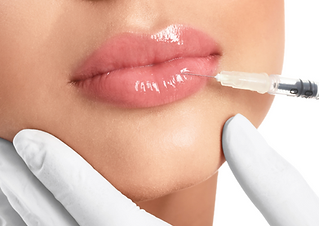 lip filler