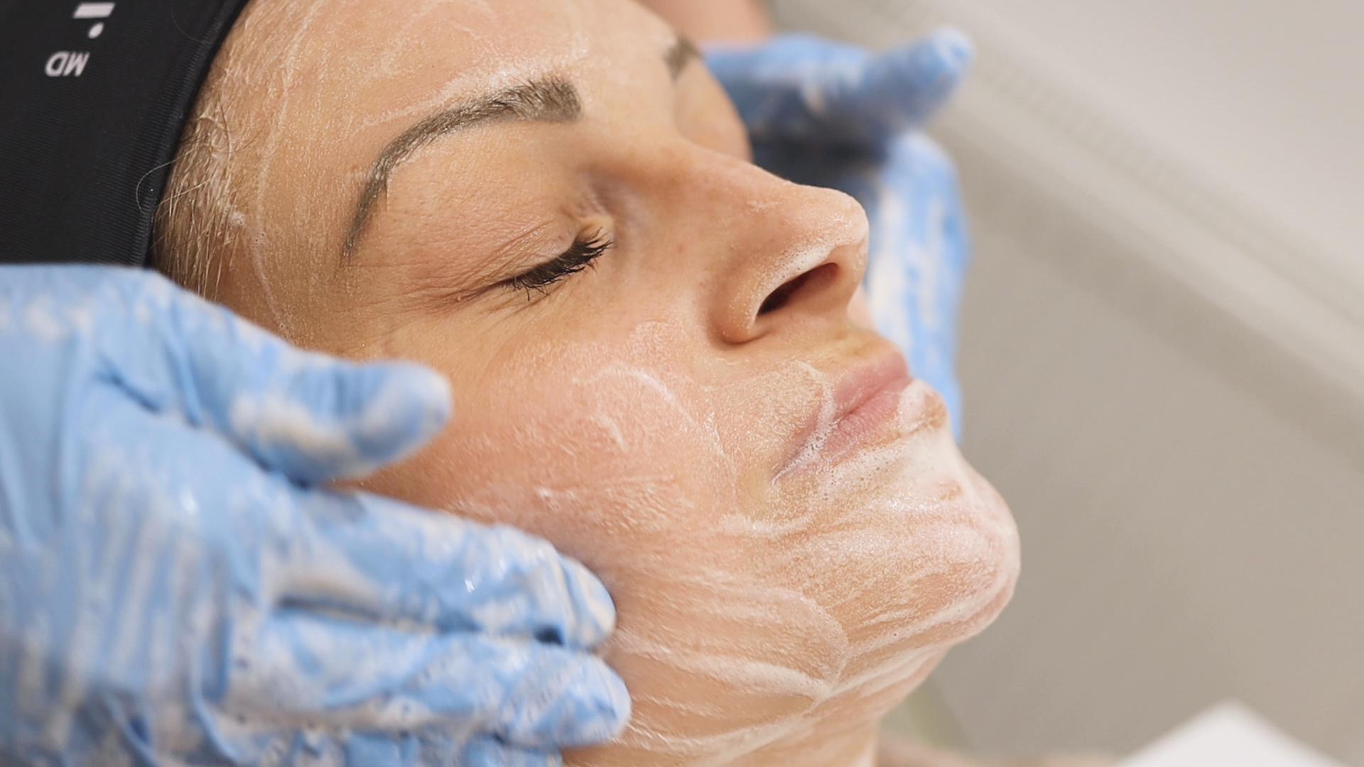 How to Build a Safe, Effective Acne Treatment Pathway