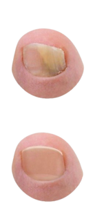 Before and After
