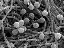 micromonospora ech.jpeg
