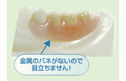 ノンクラスプデンチャー【自由診療】