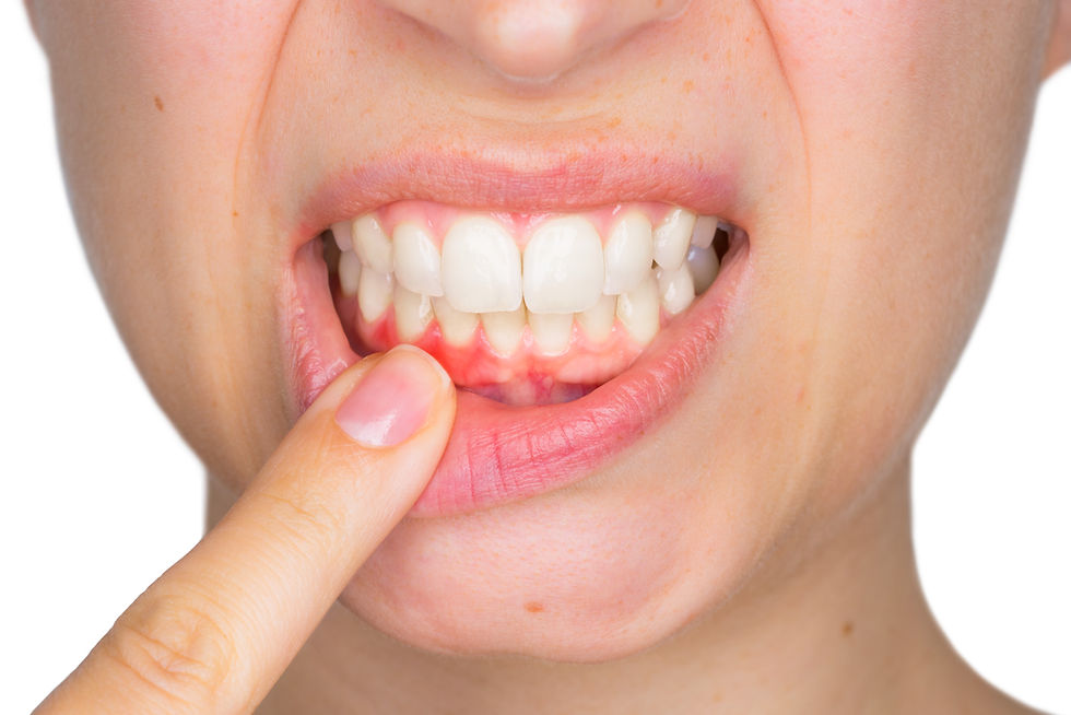 MacArthur Park Dentistry in Las Colinas & Irving, TX 75063 Family Emergency Dental Implants Invisalign Dentist - Dental Exams, Cleanings, Dental Crowns, Fillings, Bridges & Partials, Bonding, Teeth Whitening, Invisalign, ClearCorrect, Root Canal Therapy, Tooth Extractions, Veneers, Inlays & Onlays, Kid Friendly Dentistry