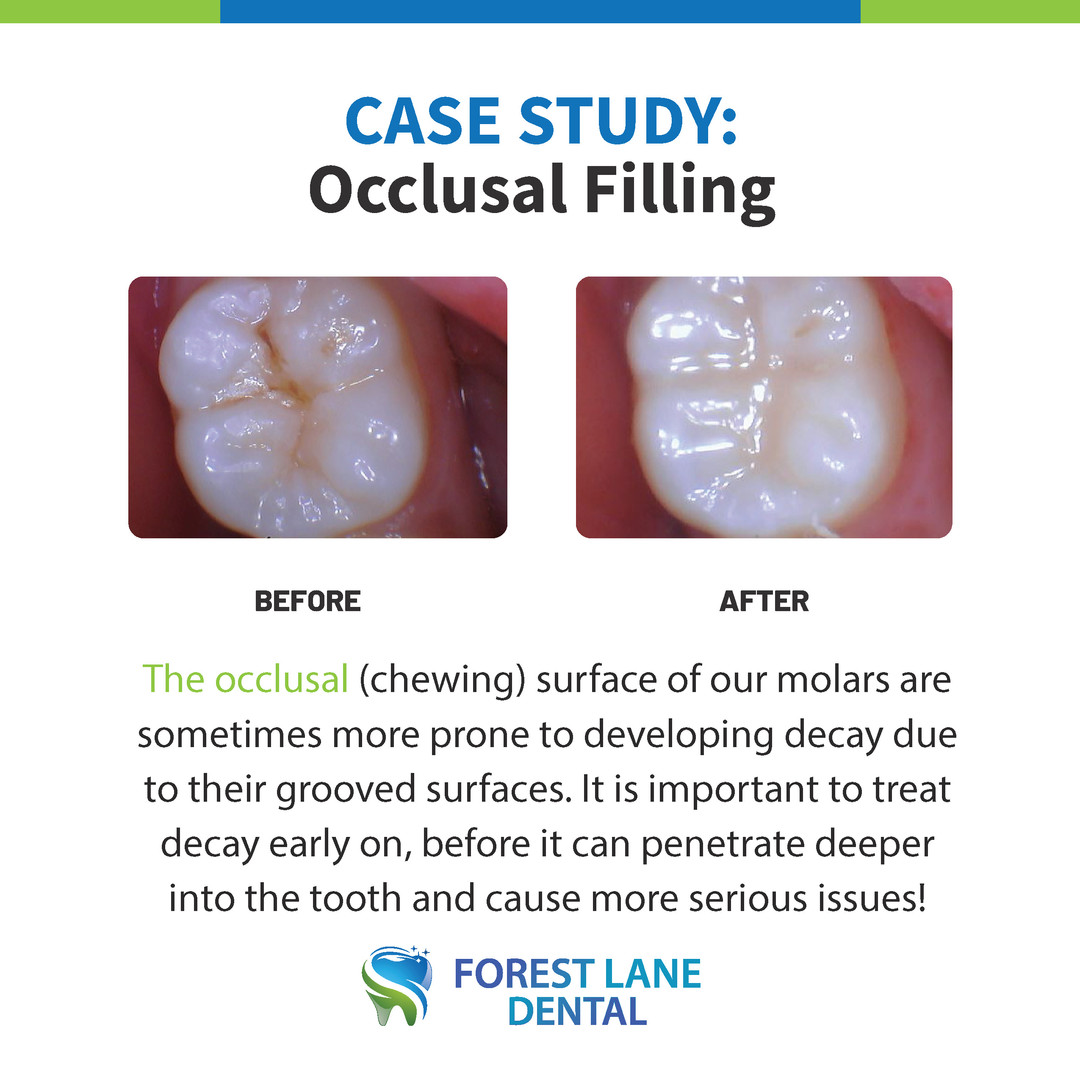 Family, Implants, Invisalign, Kids I Northwest Dallas I Forest Lane Dental