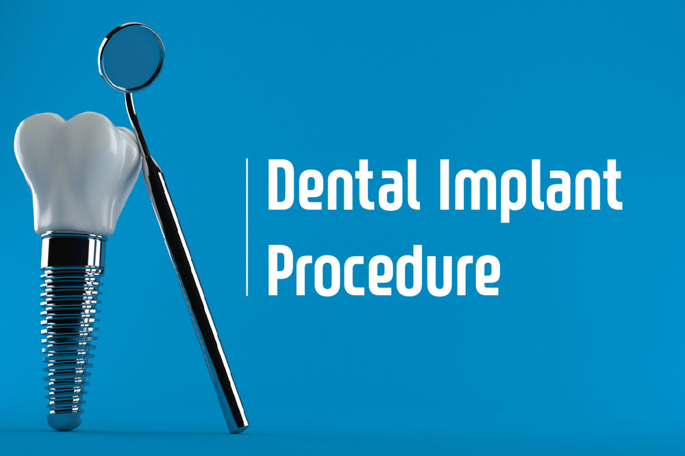 How Two Stage Dental Implants are Performed; Your General Dentist in