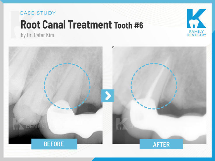 K Family Dentistry in Pflugerville, TX 78660 Emergency, Invisalign, Family ,Cosmetic - Dental Implants, Crowns, Bridges, Restorations, Veneers, Filling, Root Canal Therapy, ClearCorrect, Dentures, Teeth whitening, Inlays and onlays, Sedation Dentistry, Emergency Dentist, Kid Friendly Dentist, Dental Checkup, Cleaning & Examinations