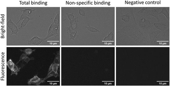 Figure 5. Fluorescence and bright-field images of total (left panels) and non-specific binding (central panels) of CELT-419 to live HEK293-D3R cells and to SKOV3 cells without D3 receptors (right panels). HEK293-D3R cells in DMEM medium with added 9% FBS and antibiotic antimycotic solution were incubated with 2 nM CELT-419 in the absence (total binding) or presence (non-specific binding) of 10 μM Spiperone for 2 h in 5% CO2 and at 37 °C. The number of seeded cells per well was 20,000. For negative control, SKOV3 cells without D3 receptors seeded at 30,000 cells per well were used with 2 nM CELT-419. The contrast of fluorescence and bright-field images was enhanced for presentation purposes only, the same lookup table was used for all images of the same imaging mode. The scale bar corresponds to 10 μm.