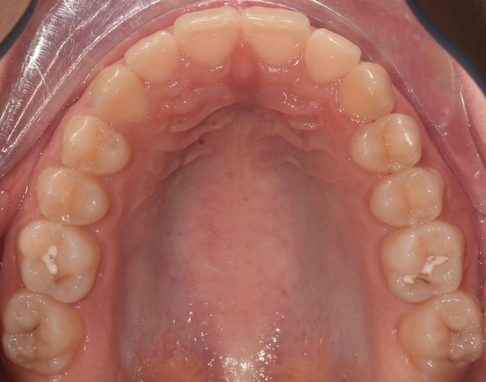 после лечения