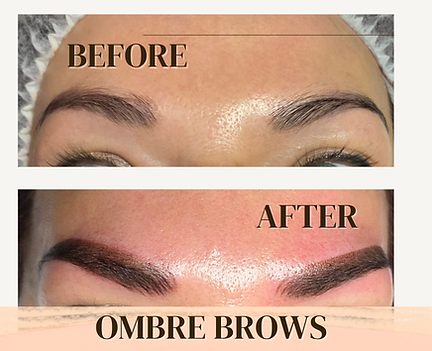 Skin Booster Norwich City  (3).png