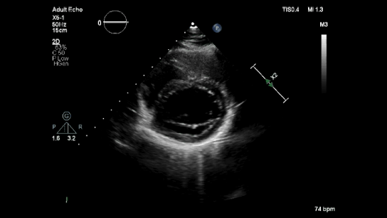 Basic Echo CVDapp