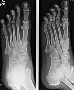 Case 4