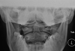 F_CSPINE_20160113_182506_edited