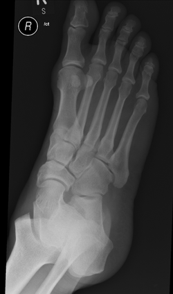 Case 20