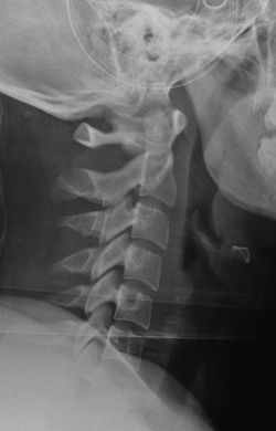 F_CSPINE_20160113_182514_edited