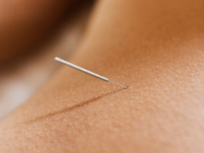 一针透两穴，周左宇、孙培荣、倪海厦﻿﻿古法针灸透穴31条