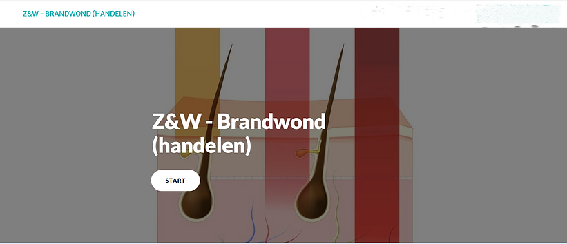 Z&W - Brandwond (handelen)