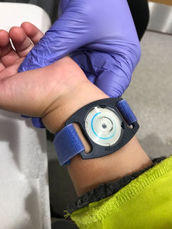 The sweat gathers in these tiny tubes and they use this to test for cystic fibrosis. 