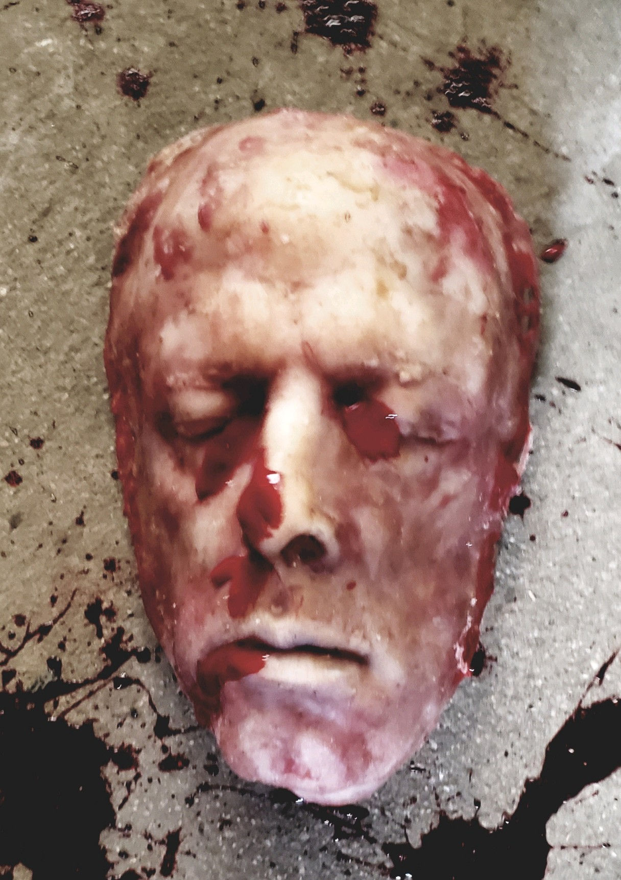 Male Skinned Face Subway