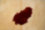 Thumbnail: Assorted Blood Plate