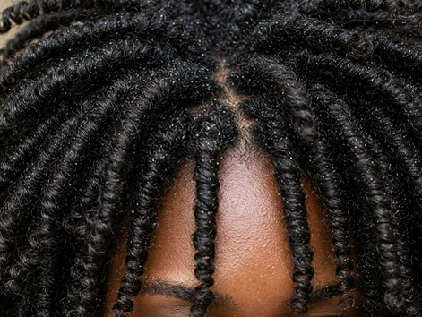 Une femme dont on voit des pellicules en gros plan à la base de sa tête