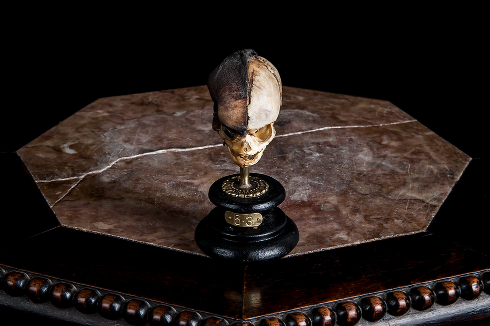 Human Fetal Skull, 18 Weeks Old - Medically Mummified