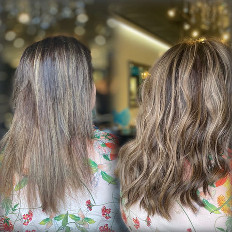 hair loss solutions Dallas