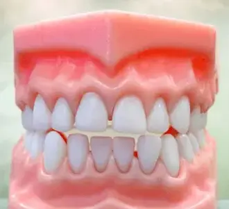 teeth.webp