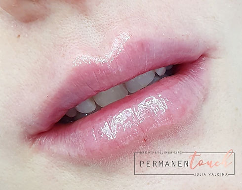 lip filler norfolk.jpeg