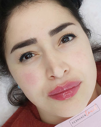 lip filler full face.jpeg