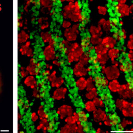 Yeni bir karaciğer ısmarlamaya ne dersiniz?