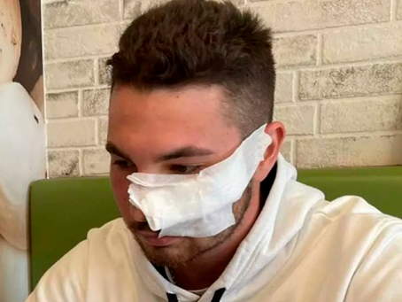 Joven termina con el rostro desfigurado tras defender a menor agredida