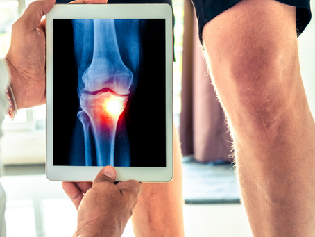 Best Hip & Knee Arthritis Treatment