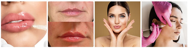 Dermal Fillers Adelaide.jpg