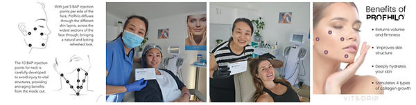 Profhilo Injections Adelaide.jpg